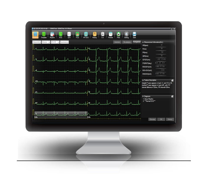 Data Management System, SE-1515, Software Required for Tabletop ECG's to send data wirelessly to PC for reporting, Support Multi-Format Reports: XML/SCP/DICOM/PDF/JPG/BMP/TIF/PNG, Replaces Smart_ECG Software (DROP SHIP ONLY)