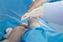 Disposable Surgical Skin Stapler 35 Wide