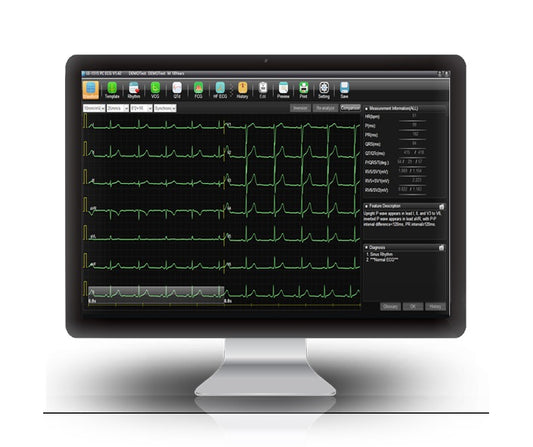 Data Management System, SE-1515, Software Required for Tabletop ECG's to send data wirelessly to PC for reporting, Support Multi-Format Reports: XML/SCP/DICOM/PDF/JPG/BMP/TIF/PNG, Replaces Smart_ECG Software (DROP SHIP ONLY)