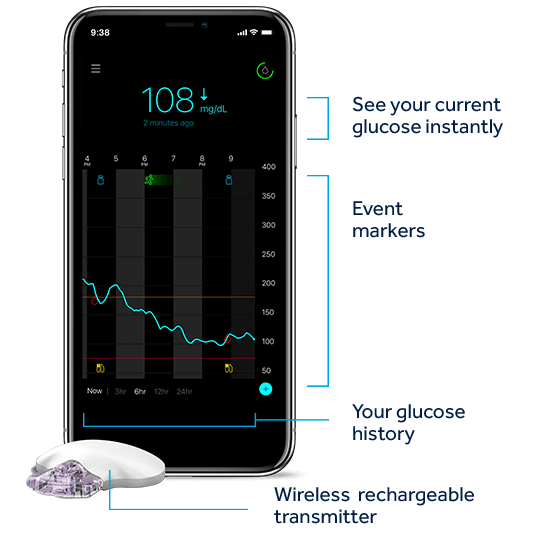 Guardian™ Connect CGM System