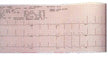 Marquette™ ECG Multi Channel Fanfold Chart Paper, 8.433" x 275 ft