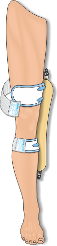 Urocare® Fabric Leg Strap Kit (6344 & 6345), Large